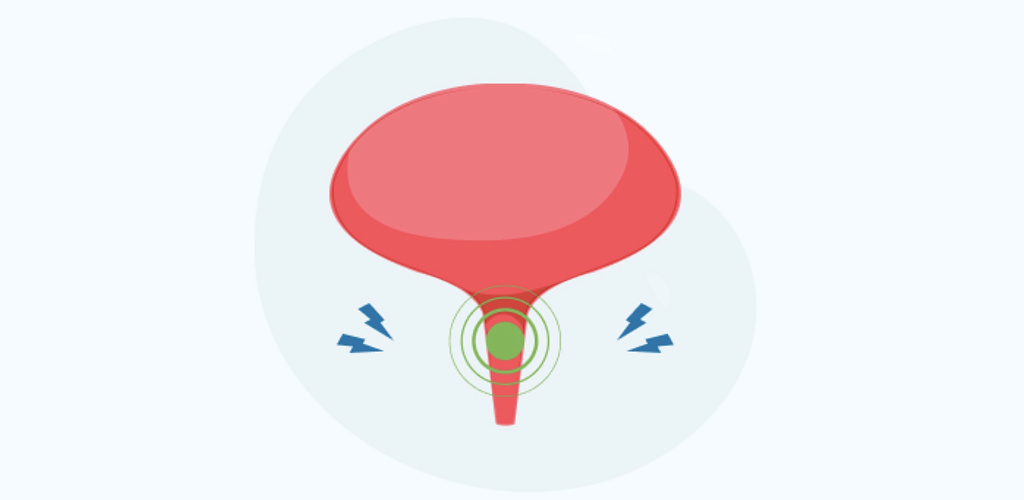 Абсцесс простаты