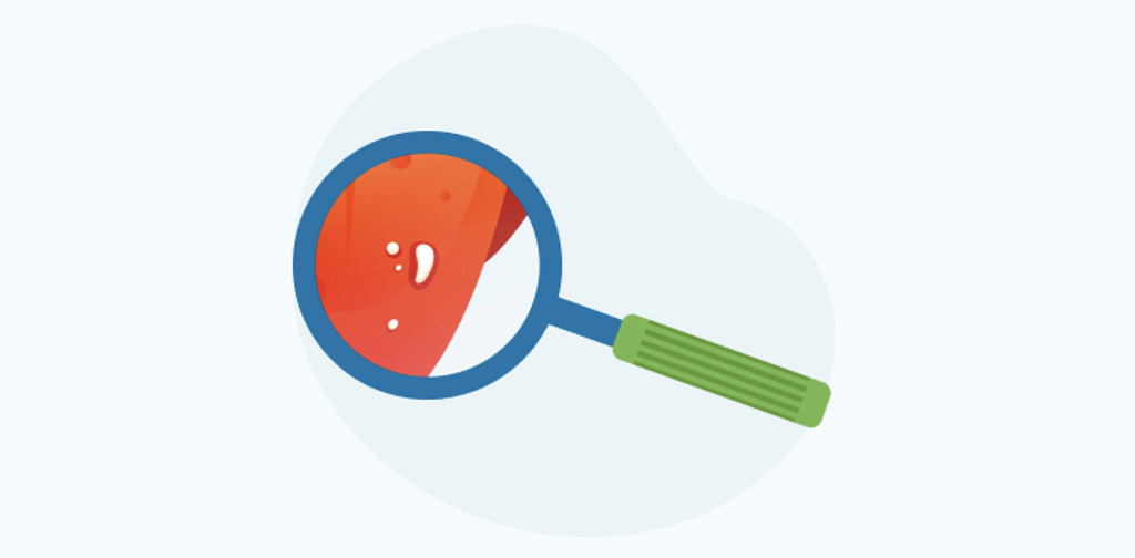 Стоматит у детей