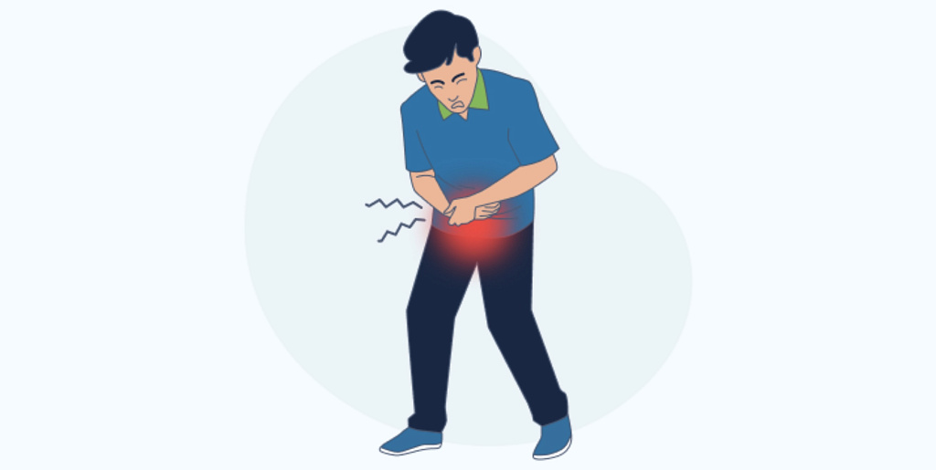 Синдром хронической тазовой боли