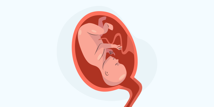 Внутриутробная инфекция