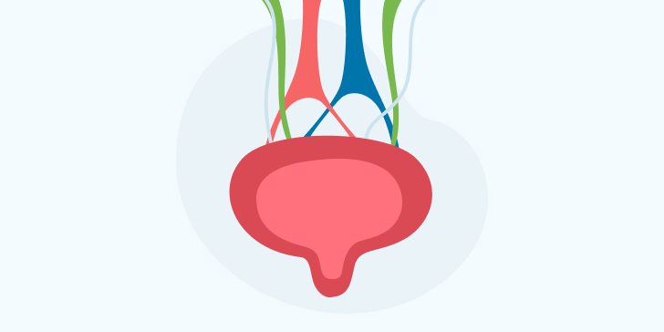 Лейкоплакия мочевого пузыря