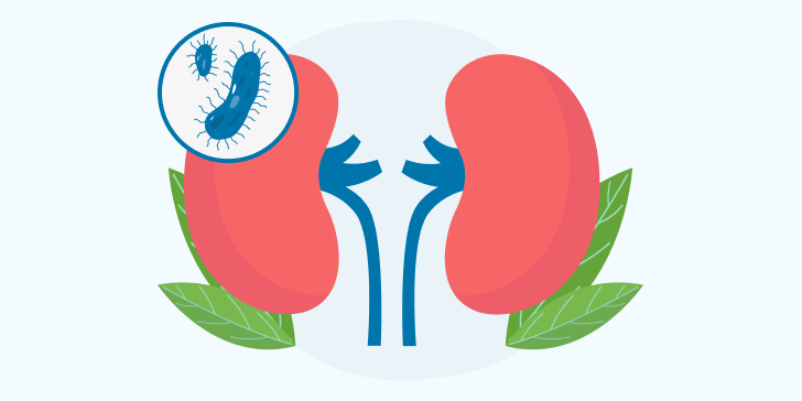 Паранефрит