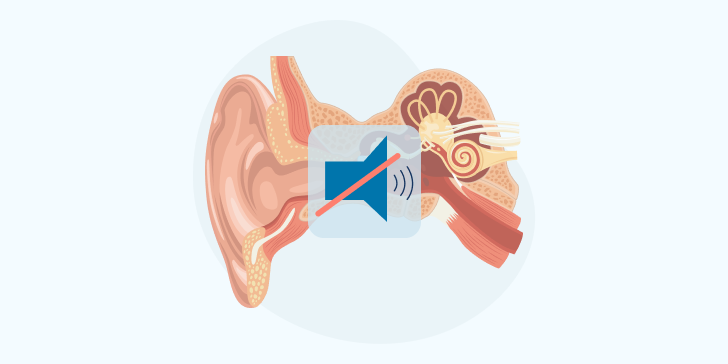 Нейросенсорная тугоухость