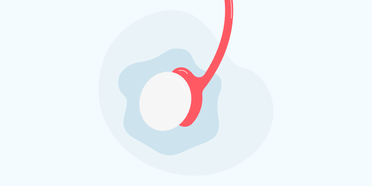 Водянка яичка у детей и подростков