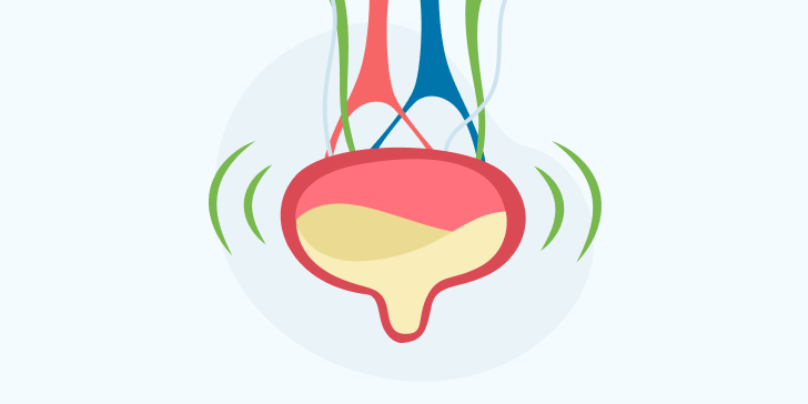 Гиперактивный мочевой пузырь