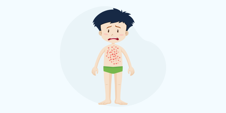 Лямблиоз у детей