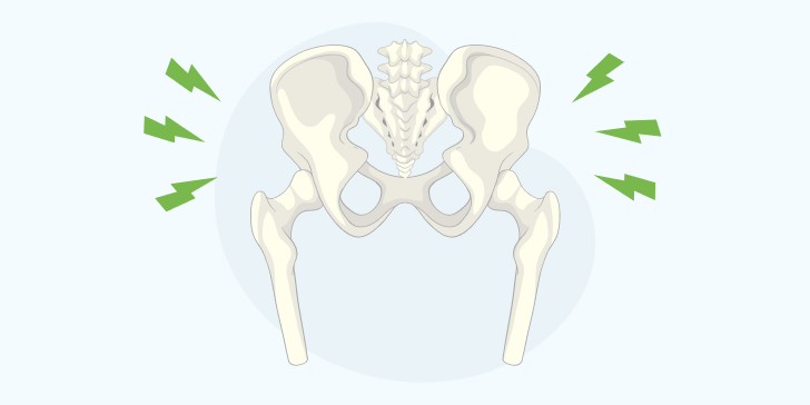 Переломы в области тазобедренного сустава
