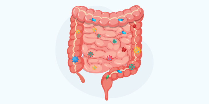 Дисбактериоз кишечника у детей