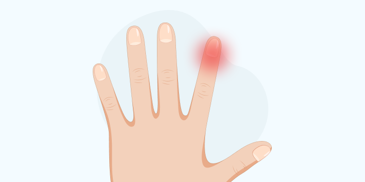 Панариций у ребенка