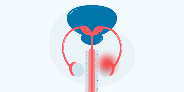 Эпидидимит