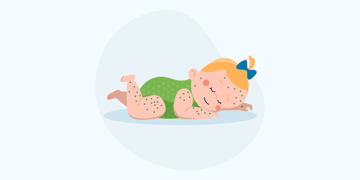 Ветряночный энцефалит