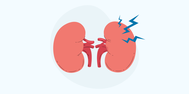 Повреждение почки