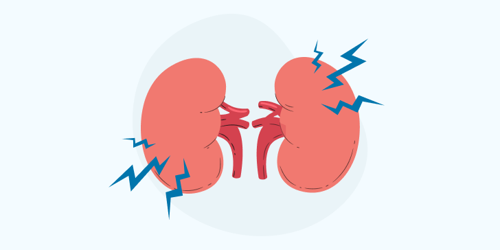 Острое повреждение почек