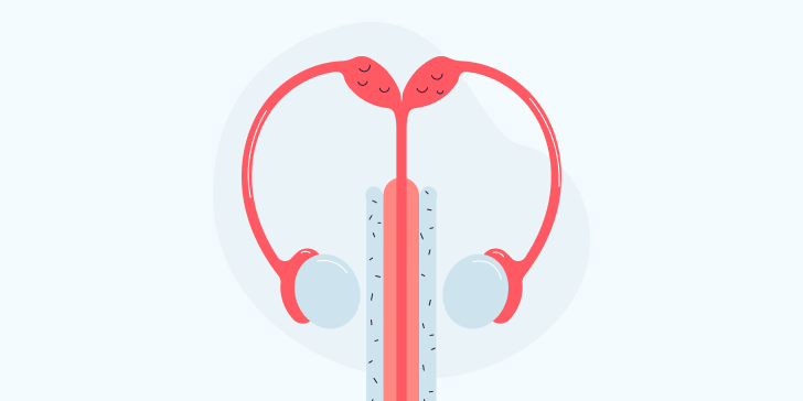 Варикоцеле после операции