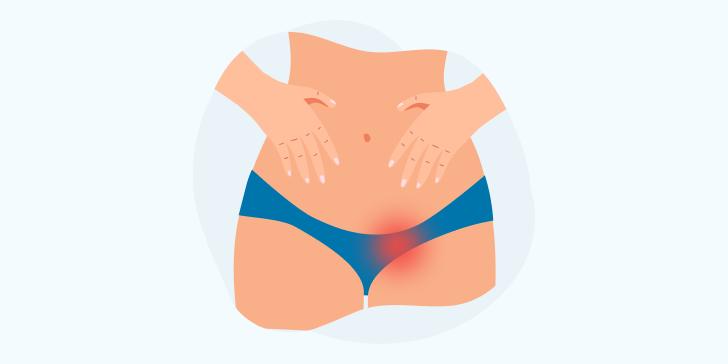 Паховая грыжа