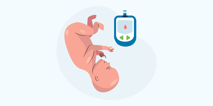 Диабетическая фетопатия