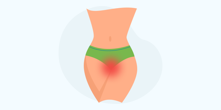 Абсцесс бартолиновой железы