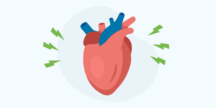 Пароксизмальная желудочковая тахикардия