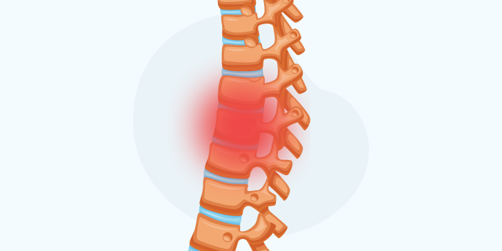 Повреждение позвоночника