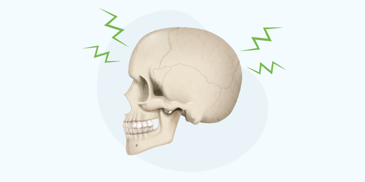 Перелом черепа