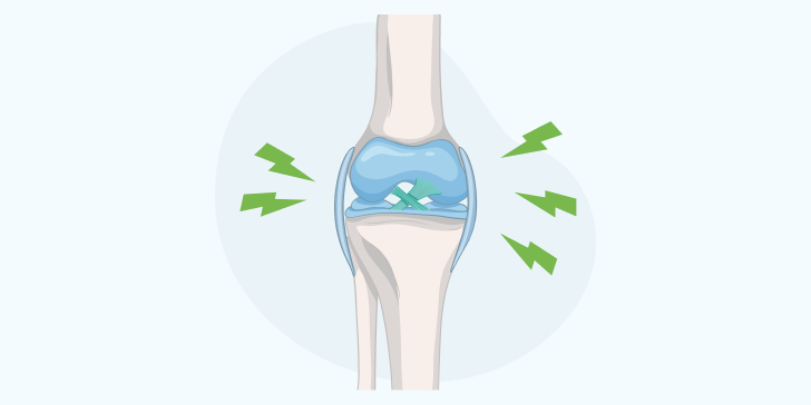 Перелом надколенника