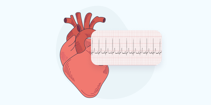 Синусовая аритмия