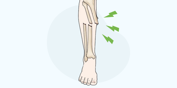 Открытый перелом