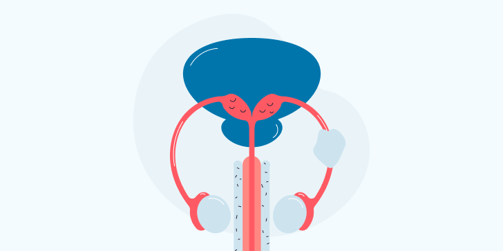 Киста семенного канатика