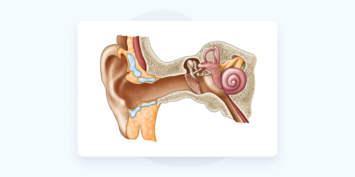 Лабиринтит