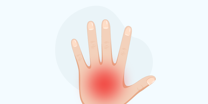 Термический ожог