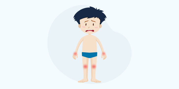 Ревматизм у детей