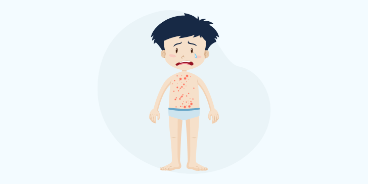 Пиодермия у детей