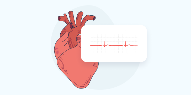 Синусовая брадикардия