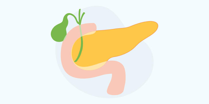 Хронический панкреатит