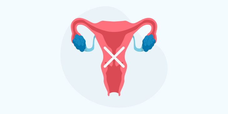 Удаление матки (гистерэктомия)