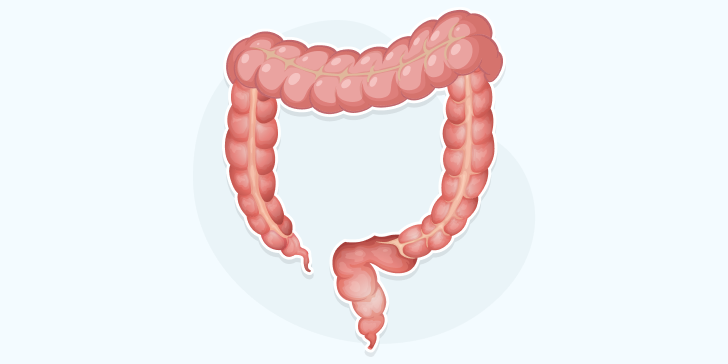 Выпадение прямой кишки