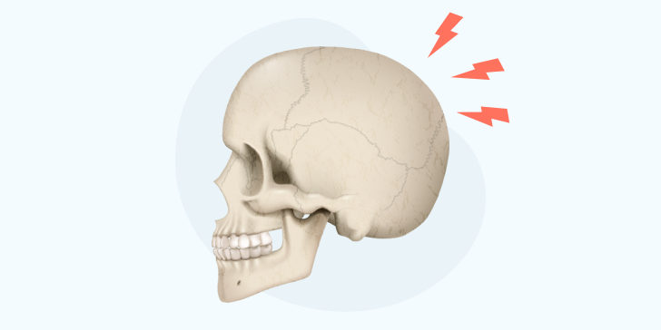 Перелом затылочной кости