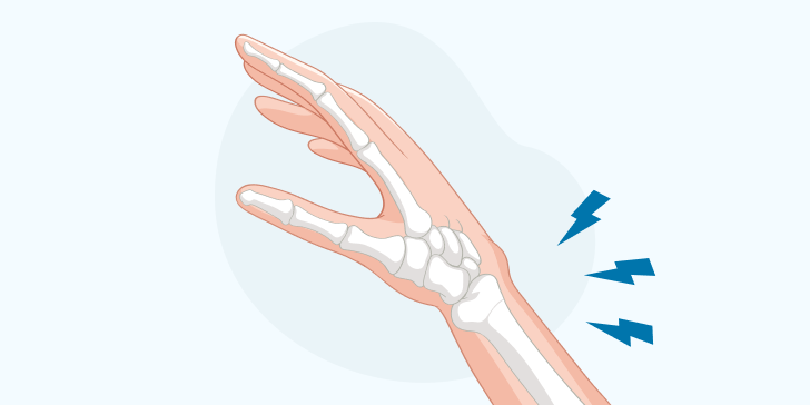 Перелом диафиза лучевой кости