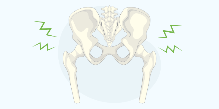 Перелом крестца