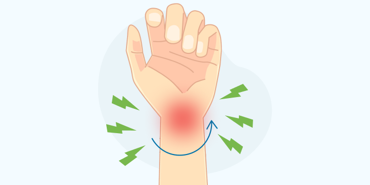 Вывих кисти