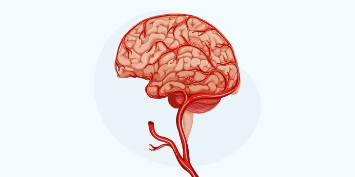 Болезни сосудов головного мозга