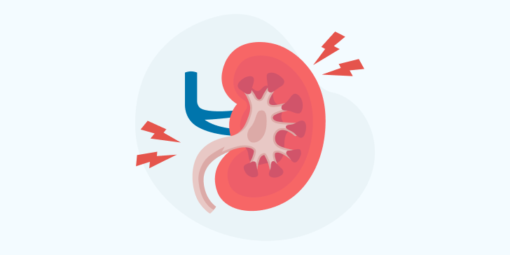 Почечная колика