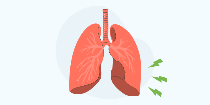 Эмпиема плевры