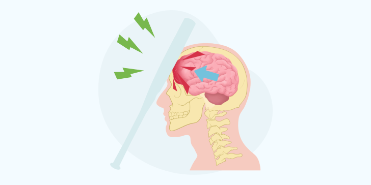 Ушиб головы