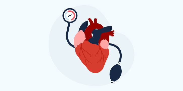 Мерцательная аритмия