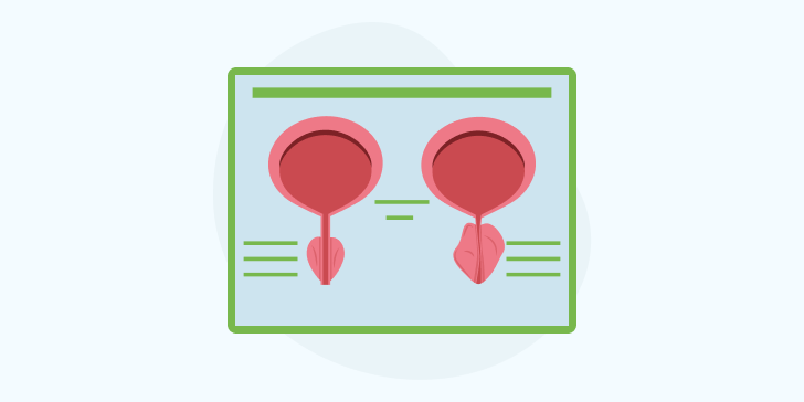 Хронический простатит