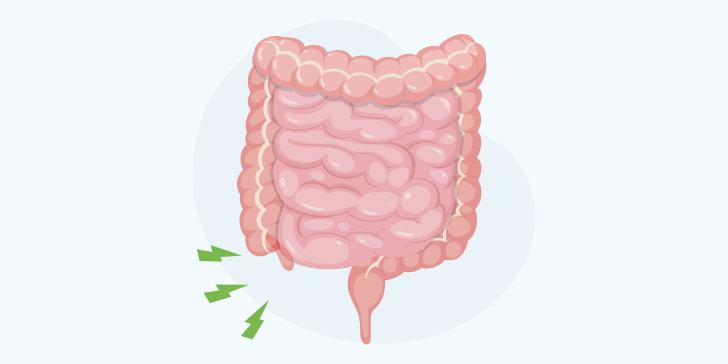 Аппендикулярный инфильтрат