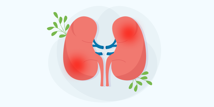 Хронический пиелонефрит