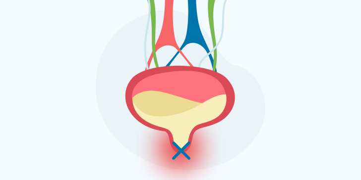 Задержка мочи