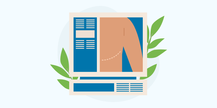 Мастэктомия